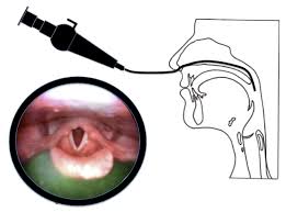 Diagnosis of Swallowing diseases (FEES and other swallowing tests)