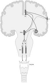 Neurological disorders of larynx